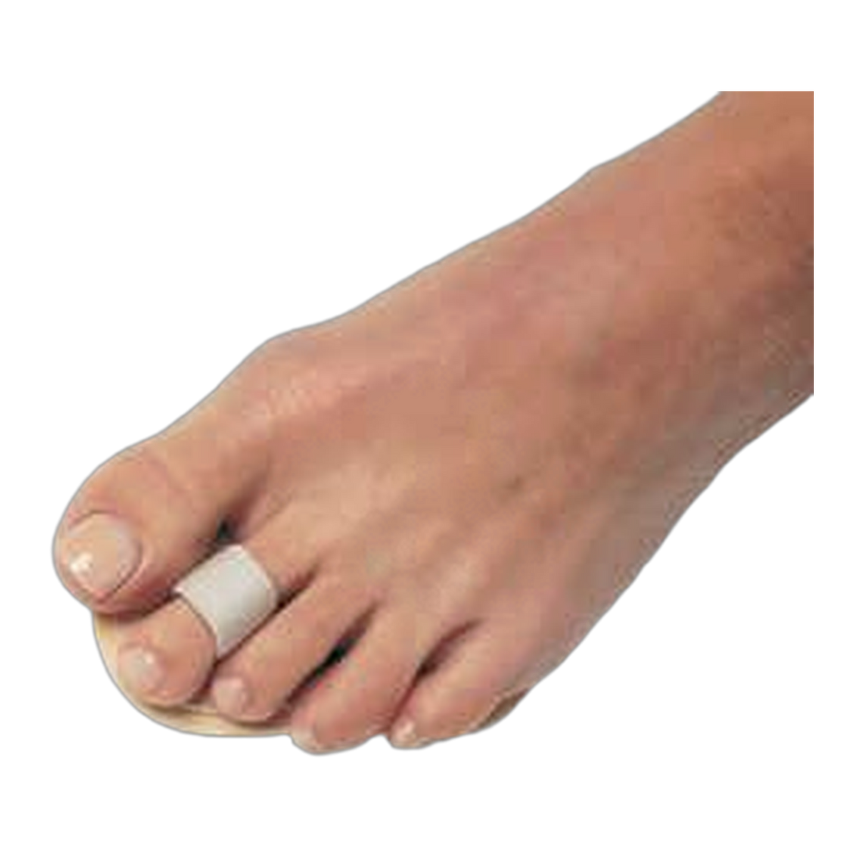 PediFix® Podiatrists' Choice® Toe Straightener